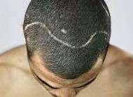 Les photos choc de Charlie Davies