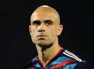 Lyon Cris a une perruque