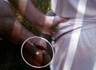 La photo du tibia ouvert de Nani