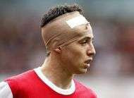 Samir Nasri a la tete qui a enfle