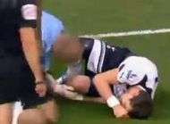 Comment Bale sest rompu les ligaments