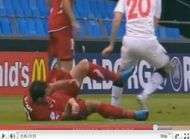 Il perd un bras en plein match