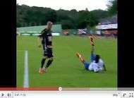 Sur une feinte il perd un bras