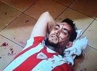 PSG un supporter de Bilbao fracasse