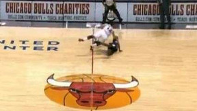 Basket : Brooks (Sacramento) perd une dent sur le parquet !